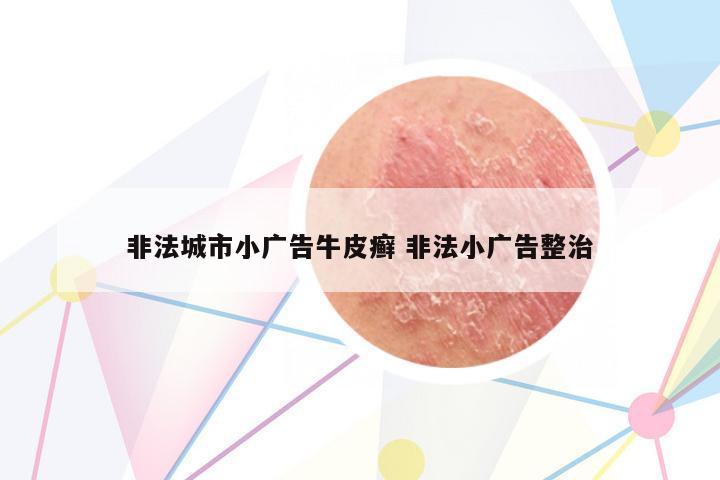 非法城市小廣告牛皮癬 非法小廣告整治