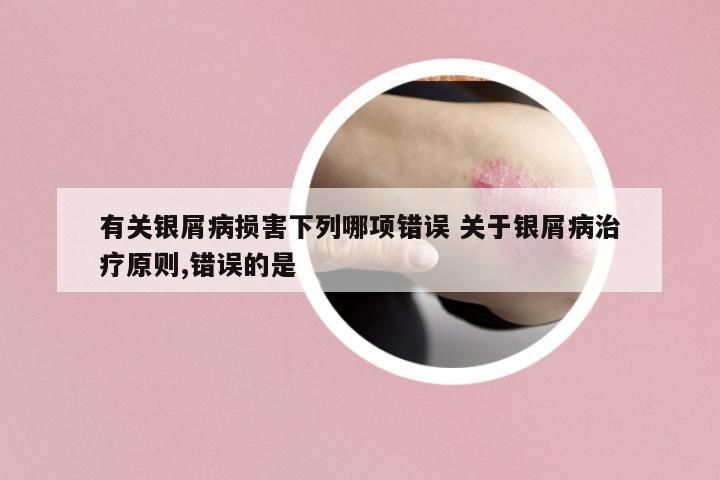 有關(guān)銀屑病損害下列哪項錯誤 關(guān)于銀屑病治療原則,錯誤的是