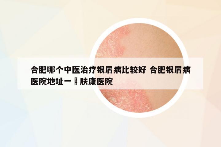 合肥哪個中醫(yī)治療銀屑病比較好 合肥銀屑病醫(yī)院地址一?膚康醫(yī)院