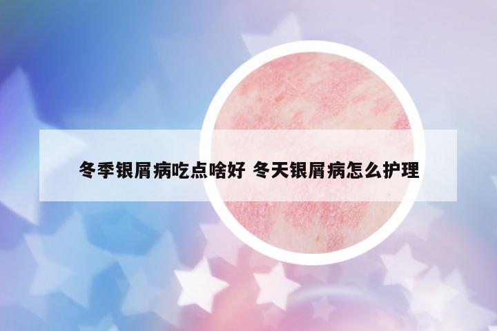 冬季銀屑病吃點(diǎn)啥好 冬天銀屑病怎么護(hù)理