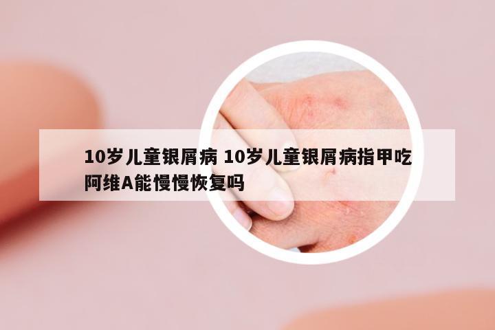 10歲兒童銀屑病 10歲兒童銀屑病指甲吃阿維A能慢慢恢復(fù)嗎