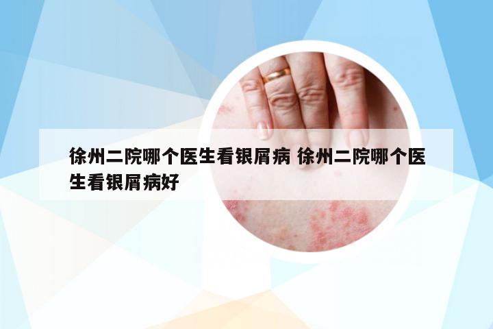 徐州二院哪個(gè)醫(yī)生看銀屑病 徐州二院哪個(gè)醫(yī)生看銀屑病好