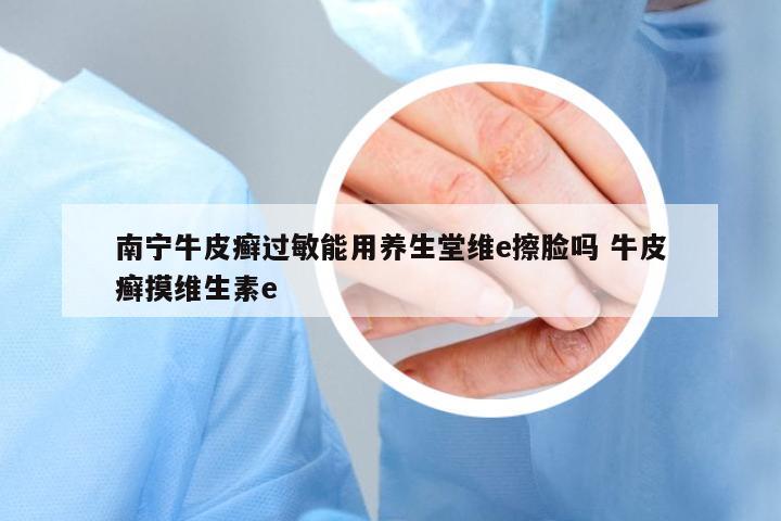 南寧牛皮癬過(guò)敏能用養(yǎng)生堂維e擦臉嗎 牛皮癬摸維生素e