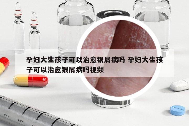 孕婦大生孩子可以治愈銀屑病嗎 孕婦大生孩子可以治愈銀屑病嗎視頻