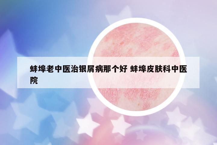 蚌埠老中醫(yī)治銀屑病那個好 蚌埠皮膚科中醫(yī)院