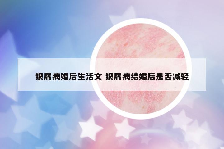 銀屑病婚后生活文 銀屑病結(jié)婚后是否減輕