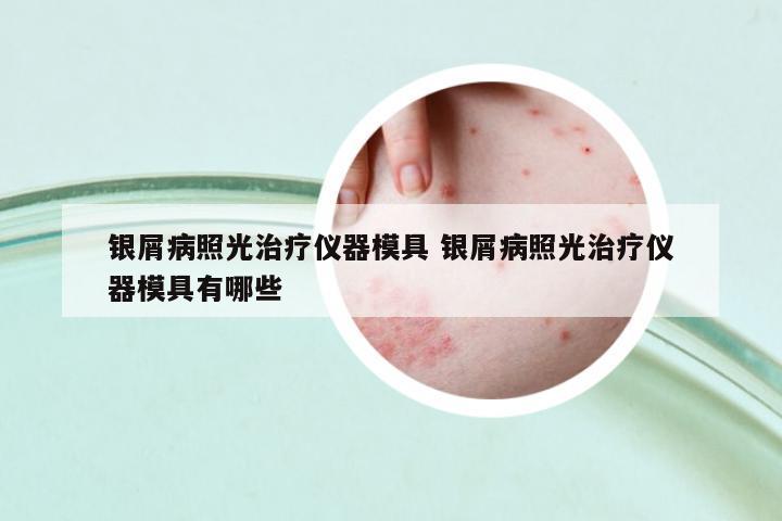 銀屑病照光治療儀器模具 銀屑病照光治療儀器模具有哪些