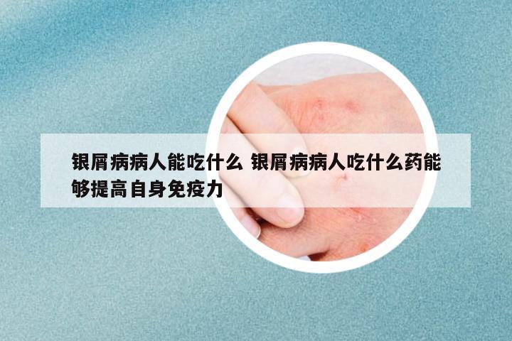 銀屑病病人能吃什么 銀屑病病人吃什么藥能夠提高自身免疫力