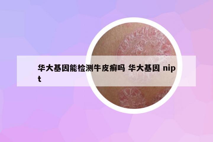 華大基因能檢測牛皮癬嗎 華大基因 nipt