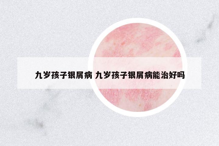 九歲孩子銀屑病 九歲孩子銀屑病能治好嗎