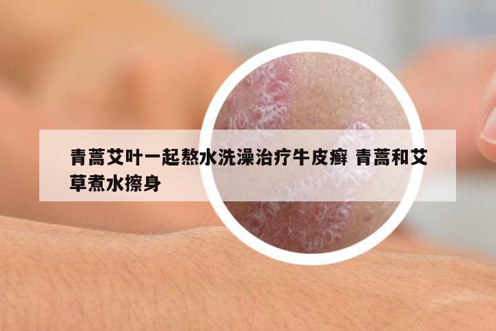 青蒿艾葉一起熬水洗澡治療牛皮癬 青蒿和艾草煮水擦身