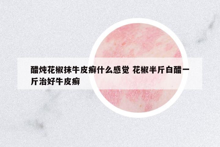 醋燉花椒抹牛皮癬什么感覺 花椒半斤白醋一斤治好牛皮癬