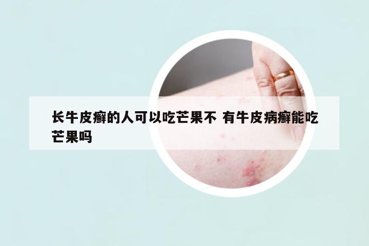長(zhǎng)牛皮癬的人可以吃芒果不 有牛皮病癬能吃芒果嗎