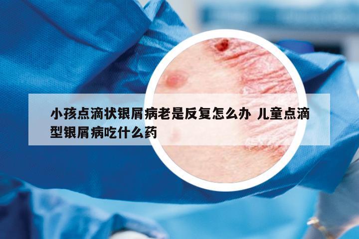 小孩點滴狀銀屑病老是反復怎么辦 兒童點滴型銀屑病吃什么藥