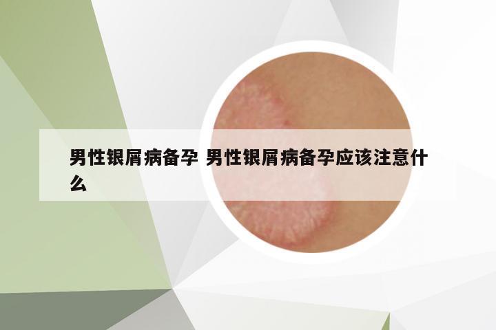 男性銀屑病備孕 男性銀屑病備孕應(yīng)該注意什么