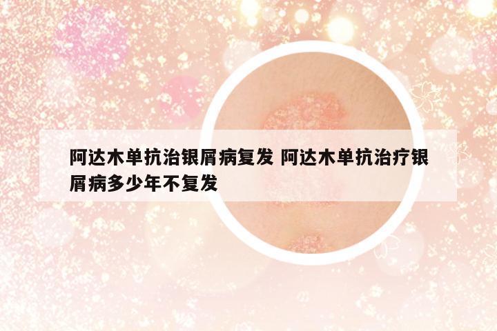 阿達木單抗治銀屑病復發(fā) 阿達木單抗治療銀屑病多少年不復發(fā)