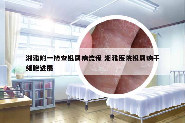 湘雅附一檢查銀屑病流程 湘雅醫(yī)院銀屑病干細胞進展