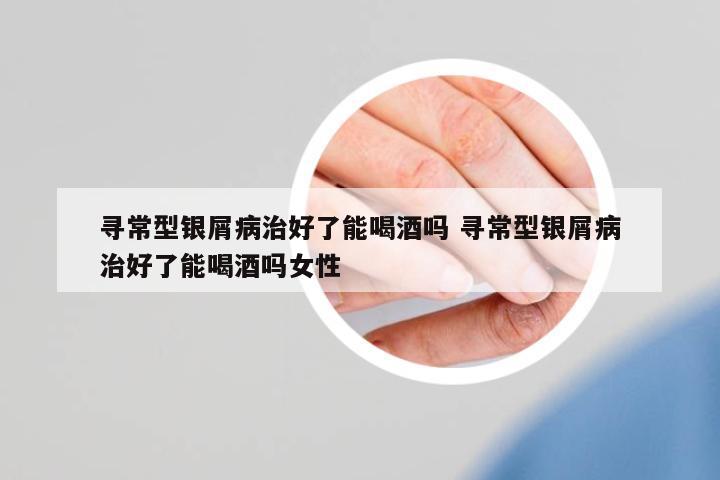 尋常型銀屑病治好了能喝酒嗎 尋常型銀屑病治好了能喝酒嗎女性
