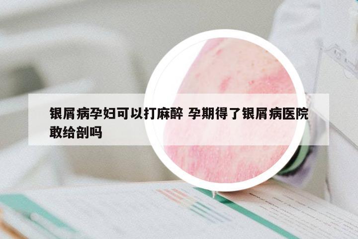 銀屑病孕婦可以打麻醉 孕期得了銀屑病醫(yī)院敢給剖嗎