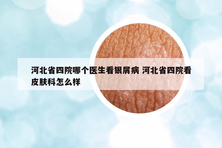 河北省四院哪個(gè)醫(yī)生看銀屑病 河北省四院看皮膚科怎么樣