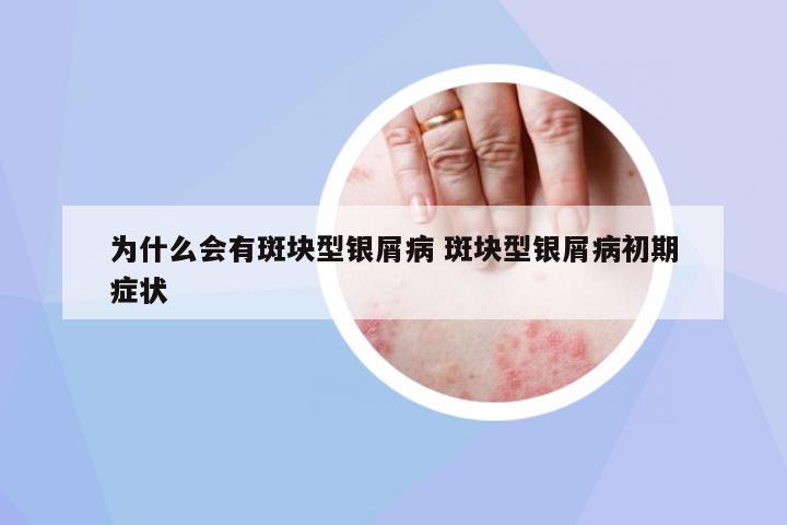 為什么會(huì)有斑塊型銀屑病 斑塊型銀屑病初期癥狀