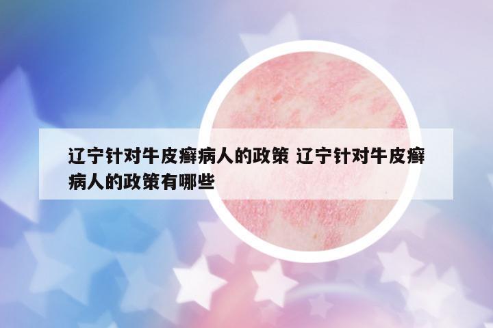 遼寧針對牛皮癬病人的政策 遼寧針對牛皮癬病人的政策有哪些