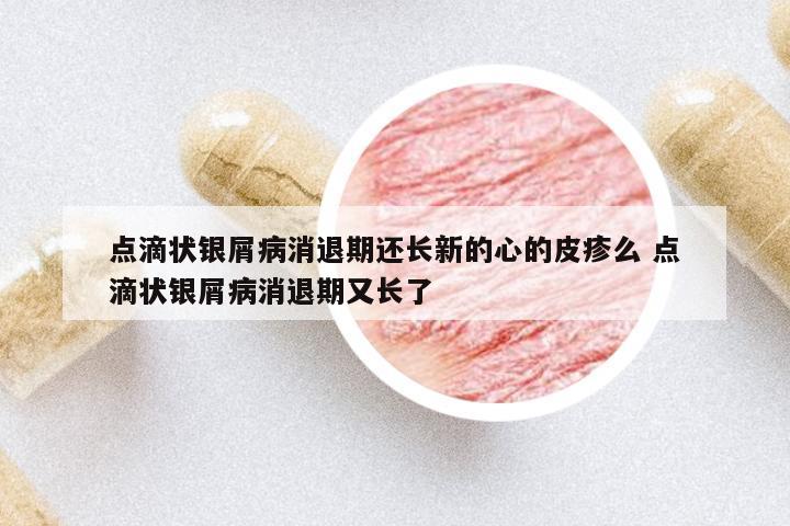 點滴狀銀屑病消退期還長新的心的皮疹么 點滴狀銀屑病消退期又長了