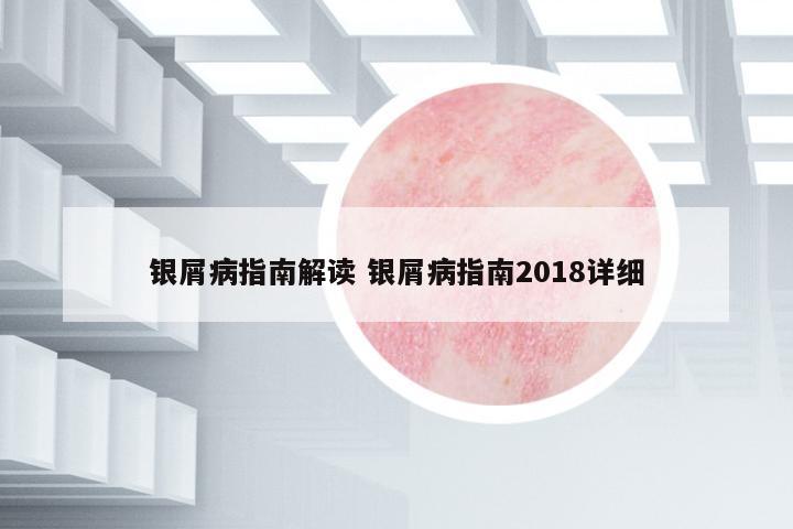 銀屑病指南解讀 銀屑病指南2018詳細