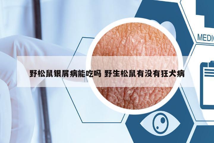 野松鼠銀屑病能吃嗎 野生松鼠有沒有狂犬病