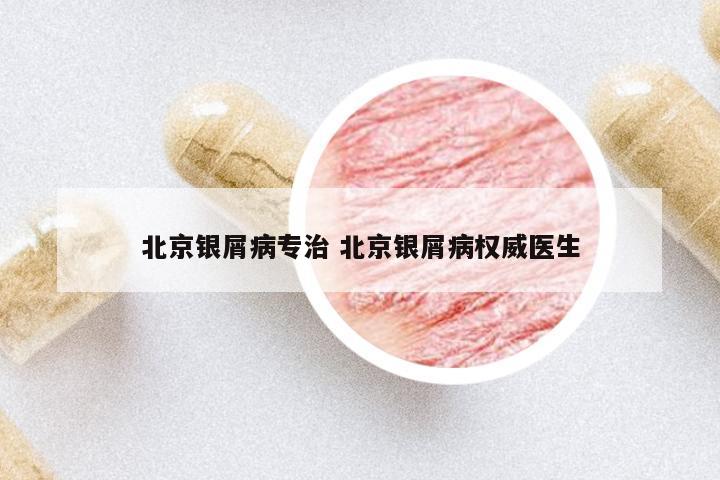 北京銀屑病專治 北京銀屑病權(quán)威醫(yī)生