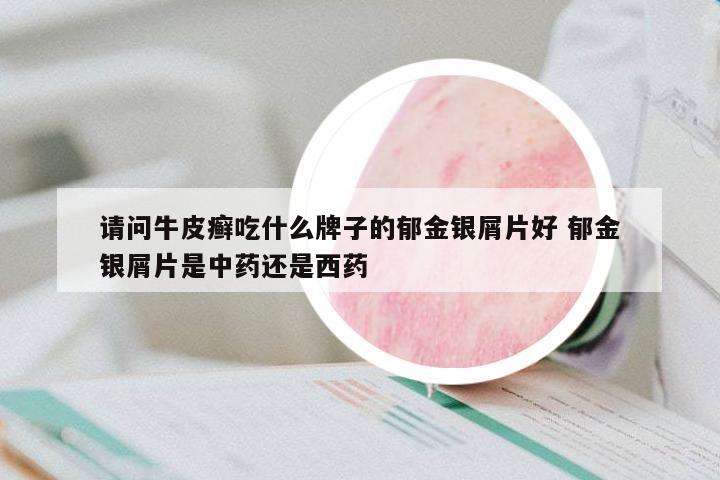 請問牛皮癬吃什么牌子的郁金銀屑片好 郁金銀屑片是中藥還是西藥