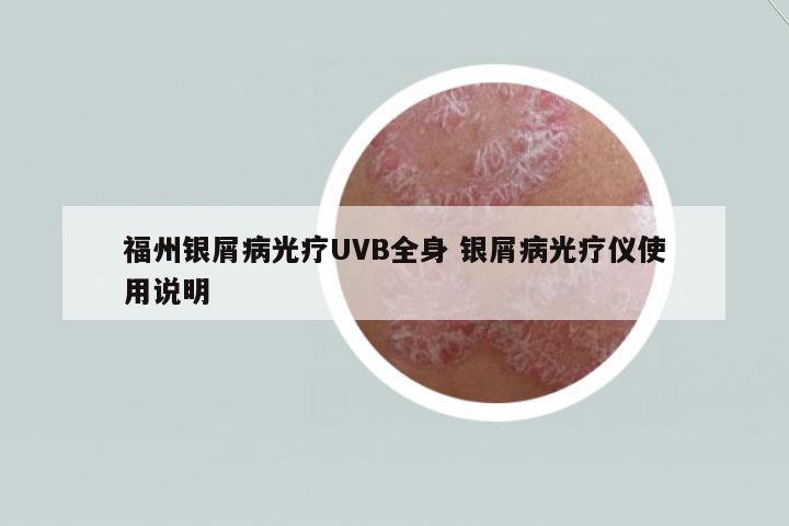 福州銀屑病光療UVB全身 銀屑病光療儀使用說明