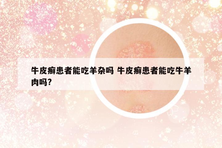 牛皮癬患者能吃羊雜嗎 牛皮癬患者能吃牛羊肉嗎?