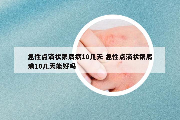 急性點(diǎn)滴狀銀屑病10幾天 急性點(diǎn)滴狀銀屑病10幾天能好嗎