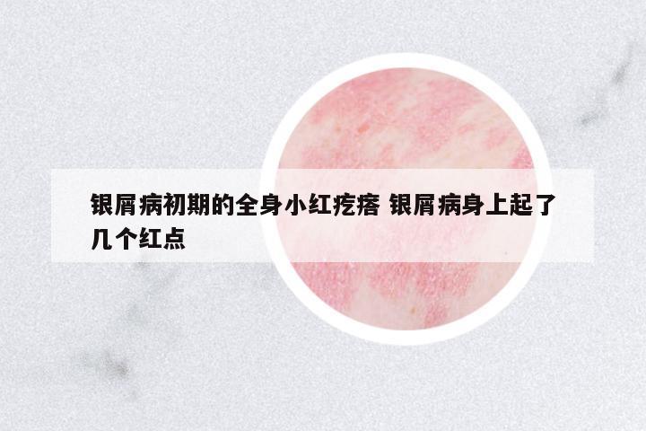 銀屑病初期的全身小紅疙瘩 銀屑病身上起了幾個紅點