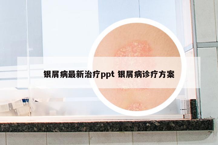 銀屑病最新治療ppt 銀屑病診療方案