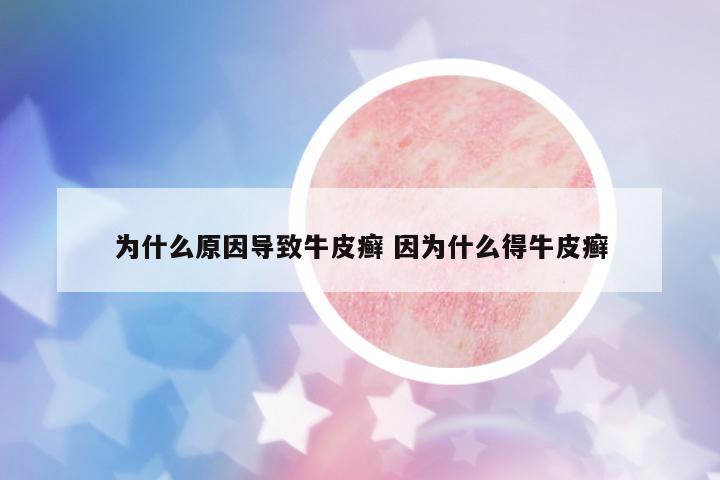 為什么原因?qū)е屡Fぐ_ 因為什么得牛皮癬