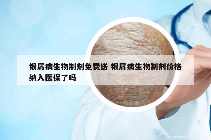 銀屑病生物制劑免費(fèi)送 銀屑病生物制劑價(jià)格納入醫(yī)保了嗎