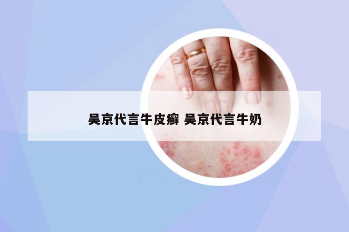 吳京代言牛皮癬 吳京代言牛奶