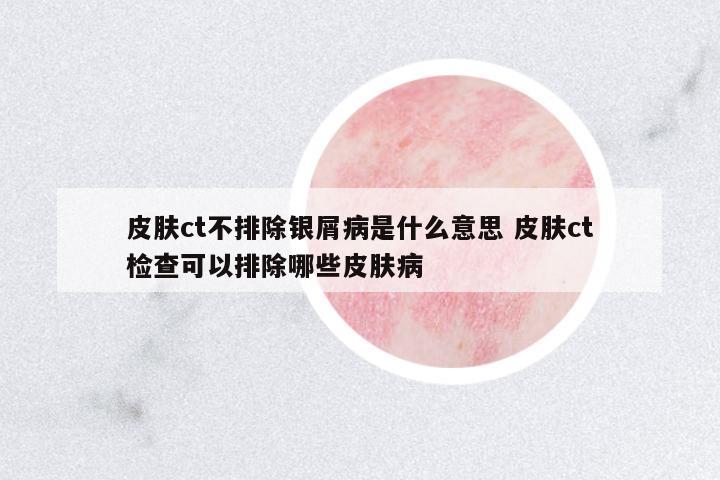 皮膚ct不排除銀屑病是什么意思 皮膚ct檢查可以排除哪些皮膚病