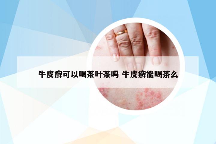 牛皮癬可以喝茶葉茶嗎 牛皮癬能喝茶么