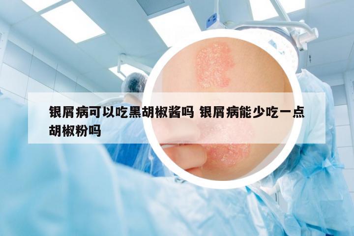 銀屑病可以吃黑胡椒醬嗎 銀屑病能少吃一點(diǎn)胡椒粉嗎