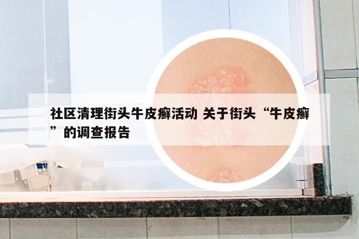 社區(qū)清理街頭牛皮癬活動 關(guān)于街頭“牛皮癬”的調(diào)查報告