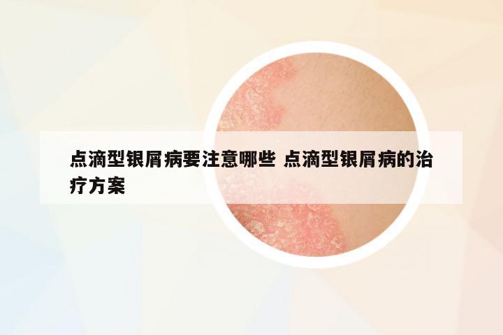 點(diǎn)滴型銀屑病要注意哪些 點(diǎn)滴型銀屑病的治療方案