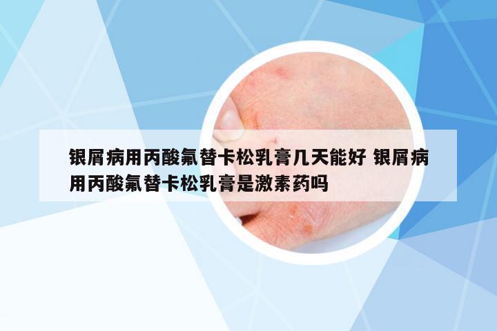 銀屑病用丙酸氟替卡松乳膏幾天能好 銀屑病用丙酸氟替卡松乳膏是激素藥嗎