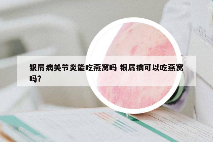 銀屑病關(guān)節(jié)炎能吃燕窩嗎 銀屑病可以吃燕窩嗎?