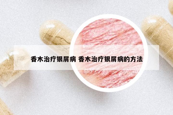 香木治療銀屑病 香木治療銀屑病的方法