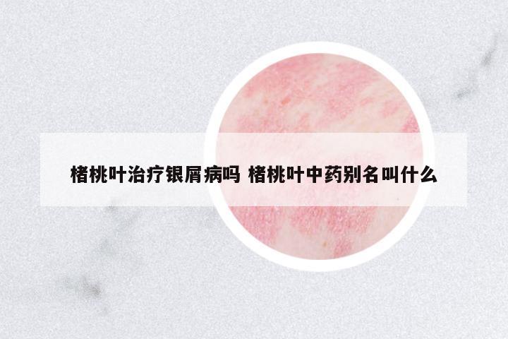 楮桃葉治療銀屑病嗎 楮桃葉中藥別名叫什么