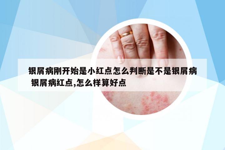 銀屑病剛開始是小紅點怎么判斷是不是銀屑病 銀屑病紅點,怎么樣算好點