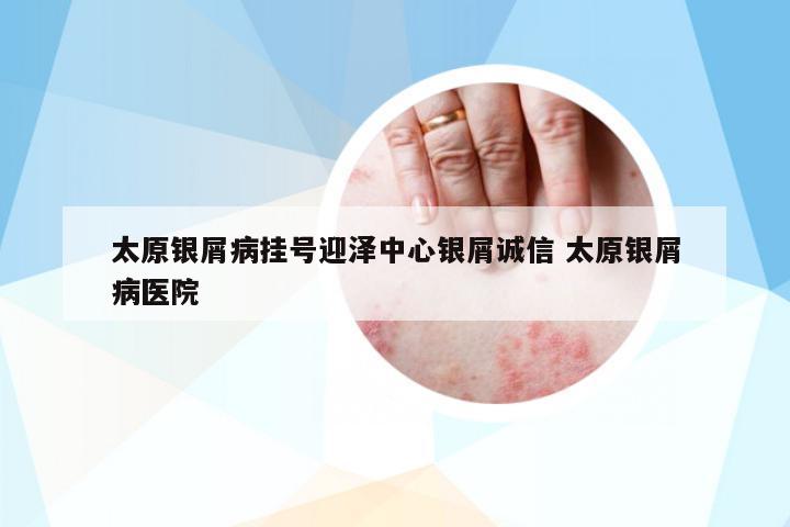 太原銀屑病掛號迎澤中心銀屑誠信 太原銀屑病醫(yī)院